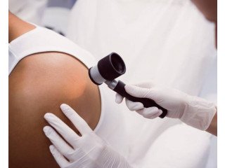 Get the Best Skin Cancer Treatment in Kalgoorlie